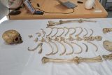 Základní škola UNESCO v Uherském Hradišti, kostra, příběh vojáka, na jehož kostře se učili žáci