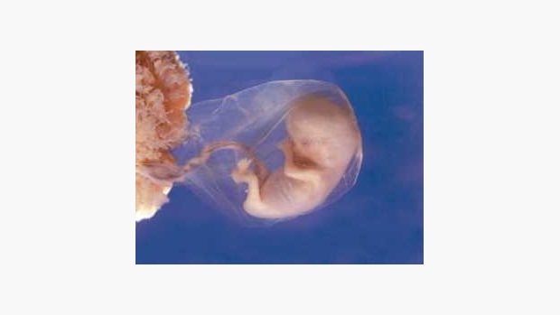 Embryo