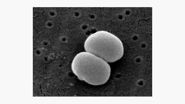 Bakterie Staphylococcus epidermidis