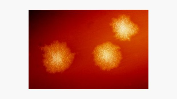Clostridium difficile