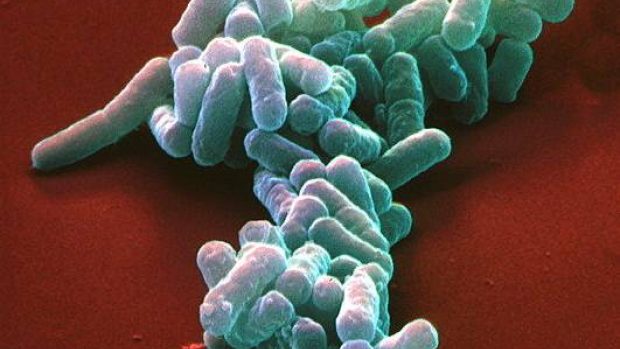 Enterohemoragické bakterie Escherichia coli (EHEC) na kolorovaném obrázku ze skenovacího elektronového mikroskopu, 5000x zvětšeno.