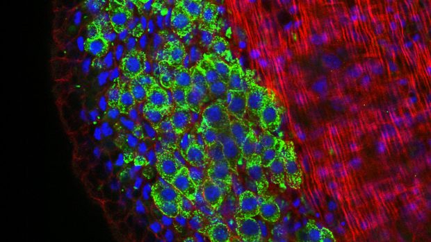Calreticulin. Protein, který povede ke skutečně personalizované onkologické léčbě.