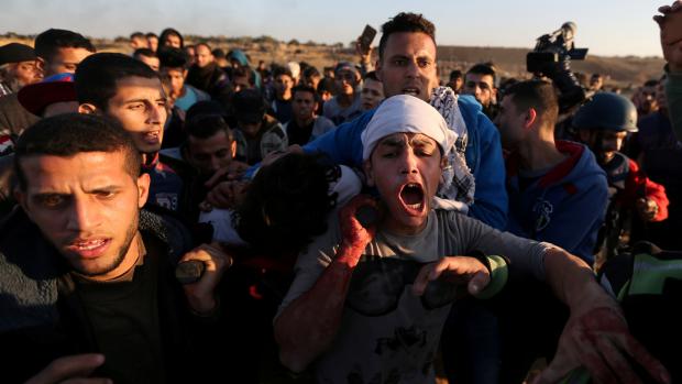 Zraněný palestinský protestující po střetech demonstrantů s Izraelskými jednotkami v pásmu Gazy