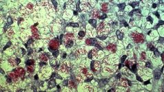 Mycobacterium leprae (zobrazeno pomocí Zeihl-Neelsenova barvení)