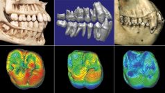 Srovnání zubního chrupu a horní první stoličky. Zleva: člověk, Ardipithecus ramidus, šimpanz