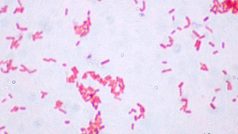 Escherichia coli v Gramově barvení. 1000× zvětšeno.