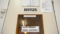 Rentgen. Ilustrační foto.