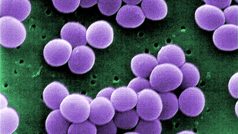 Staphylococcus aureus, zlatý stafylokok, 20,000x zvětšeno pod elektronovým mikroskopem