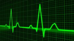 EKG, lidský puls, srdce, nemoc, zdavotnictví