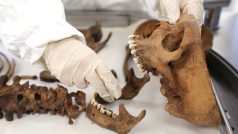 Forenzní lékař zkoumá kosti neidentifikované oběti v laboratoři kanceláře generálního prokurátora v Bogotě.