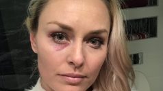 Lindsey Vonnová po super-G na MS
