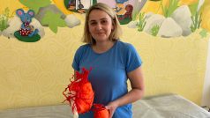 Lékaři z Fakultní nemocnice v Brně se na modelu vytištěném 3D tiskárnou připravili na operace cévních anomálií