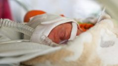V Česku se po 15 letech narodila čtyřčata - Monika