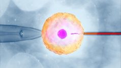 Spojení vajíčka se spermií při umělém oplodnění