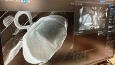 Snímek gombíku pod elektronovým mikroskopem