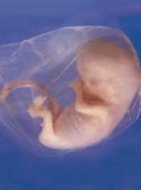 Embryo