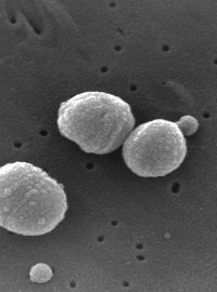 Streptococcus pneumoniae - původce zápalu plic