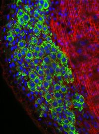 Calreticulin. Protein, který povede ke skutečně personalizované onkologické léčbě.