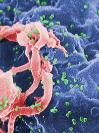 Množící se retrovirus HIV-1 (zelené tečky)