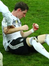 Německý záložník Sebastian Rudy se zlomeným nosem