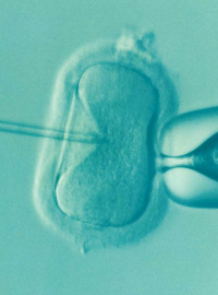 IVF, umělé oplodnění