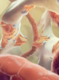 Řídnutí kostí je jedním z příznaků osteoporózy