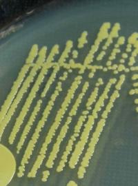Kolonie pigmentovaného zlatého stafylokoka (ilustrační foto).